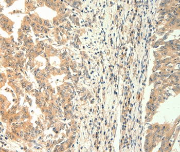 TRPM5 Antibody