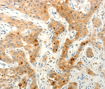 FAT4 Antibody