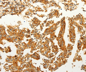 FZD6 Antibody