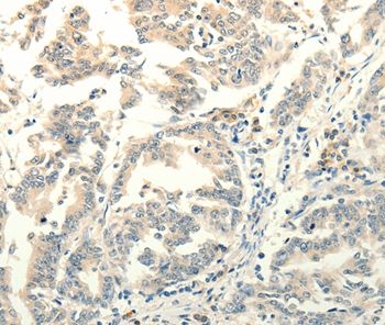 FZD8 Antibody