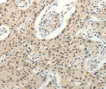 FZD10 Antibody