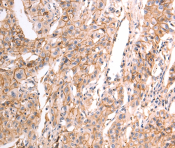 pan CDH Antibody