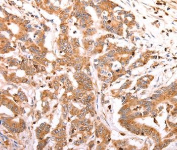 CELSR2 Antibody