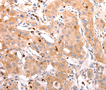 CELSR2 Antibody