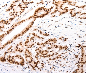 CASP9 (active) Antibody