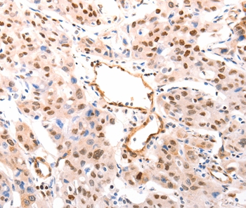 CASP9 (active) Antibody