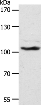 ADAMTS17 Antibody