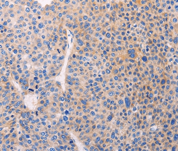 ADCY1 Antibody