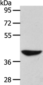 ADH1B Antibody