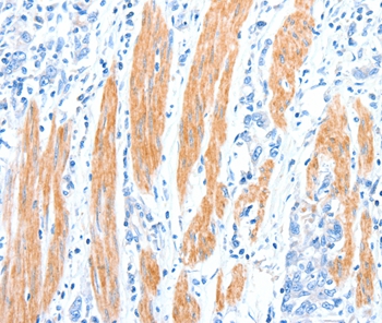 AKT3 Antibody