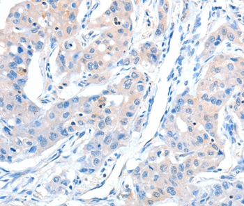 AKT3 Antibody