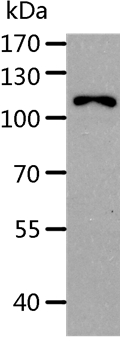 AARS Antibody