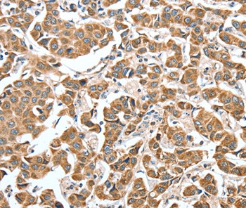 ALDH9A1 Antibody