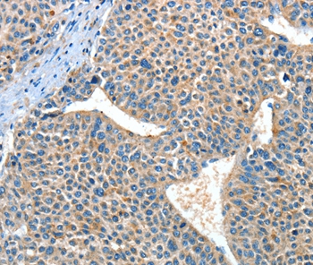 ADRA1A Antibody