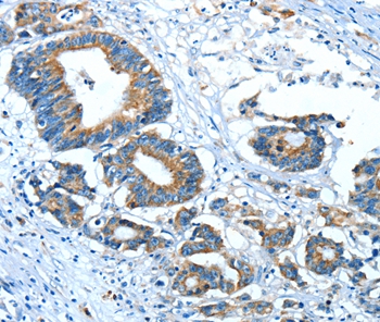 GLRA1 Antibody