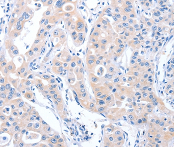 ARHGEF6 Antibody