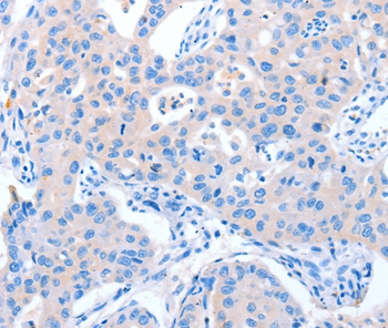 NUAK1 Antibody