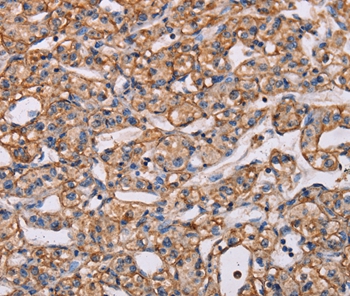 ARAP1 Antibody