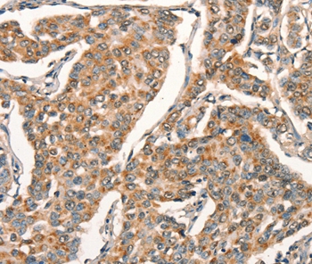 ARFRP1 Antibody