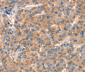 ARHGAP4 Antibody