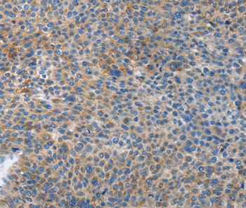 ATG4B Antibody