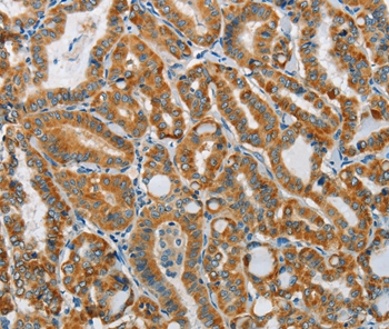 PITX3 Antibody