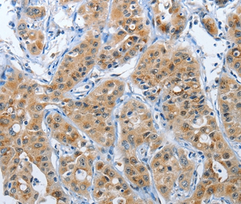 PFDN6 Antibody