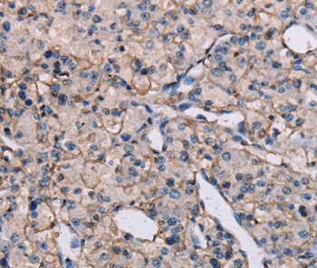 EPHA7 Antibody