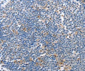 PIK3R2 Antibody