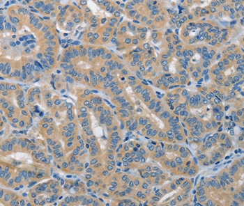 PIK3R4 Antibody