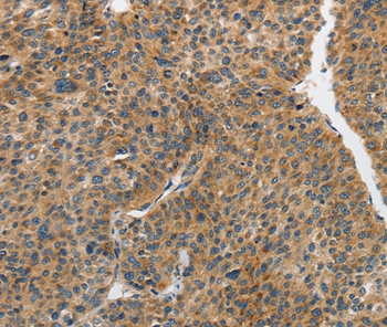 PIP5K1C Antibody