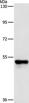 PFKFB2 Antibody