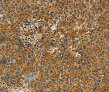 NPAP1 Antibody