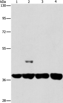 SERPINA9 Antibody