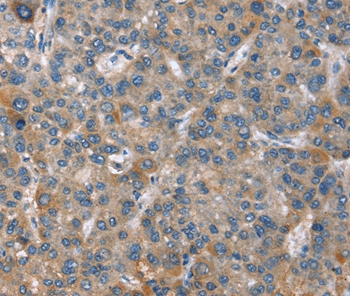 GINS1 Antibody