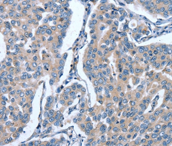 GINS1 Antibody