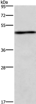 UHMK1 Antibody