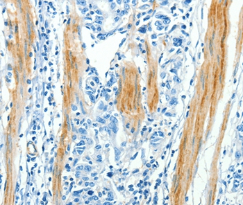 CAV3 Antibody