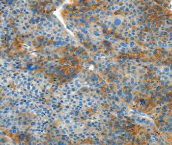 L1CAM Antibody