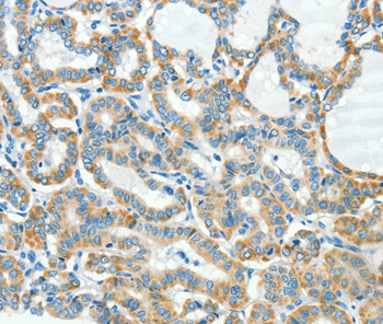 L1CAM Antibody