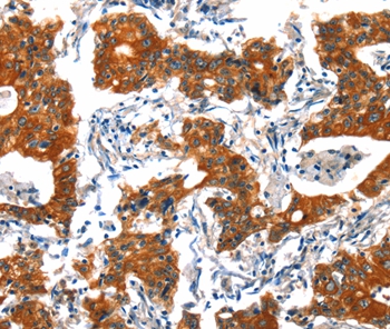 HTR3B Antibody