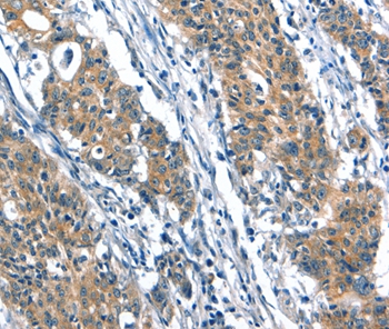 A4GALT Antibody