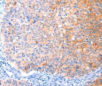 CCDC88A Antibody