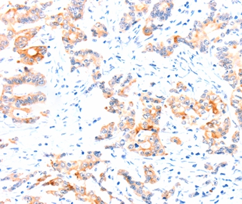 CCDC88A Antibody