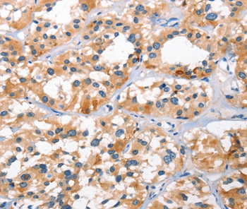 BNIP3L Antibody