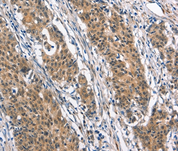 BNIP3L Antibody