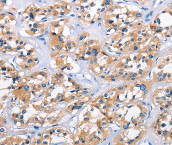 APOL6 Antibody