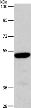 ARSB Antibody