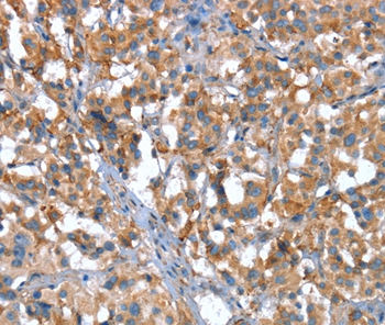 CACNA1G Antibody