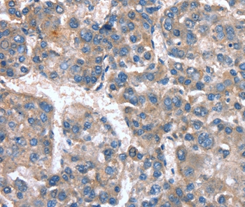 CACNA1G Antibody